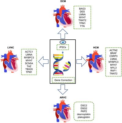 Uncovering Inherited Cardiomyopathy With Human Induced Pluripotent Stem Cells